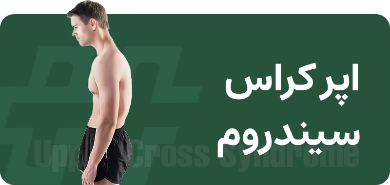 اپر کراس سیندروم 2