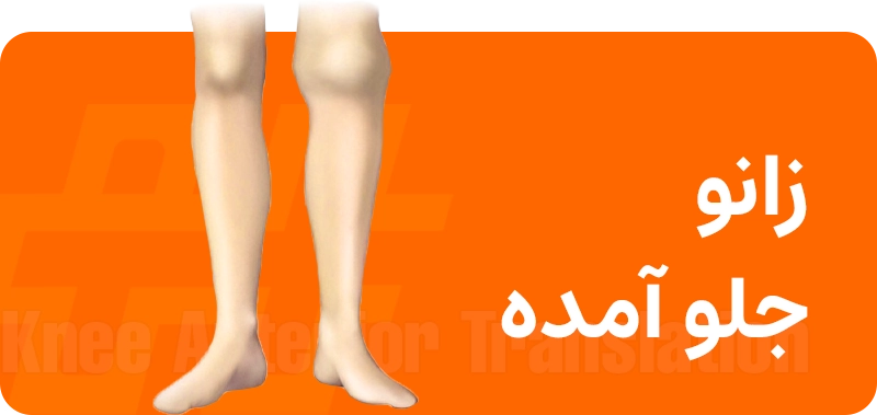 زانو جلو آمده