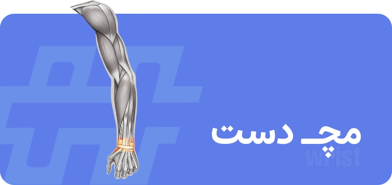 مچ دستت