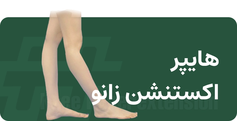 هایپر زانو