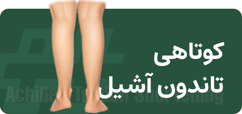 کوتاهی تاندون آشیل 2