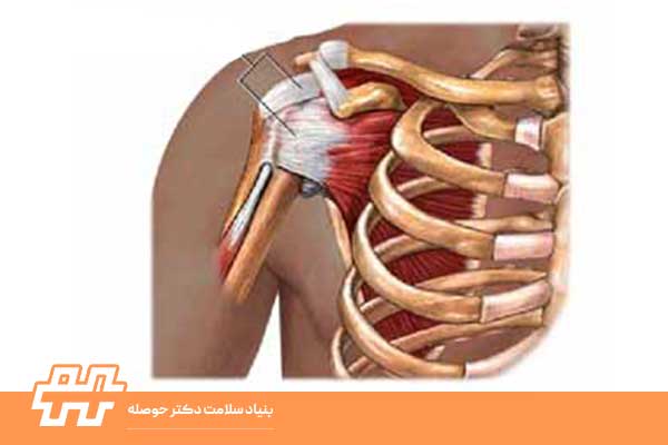 سوپراسپیناتوس