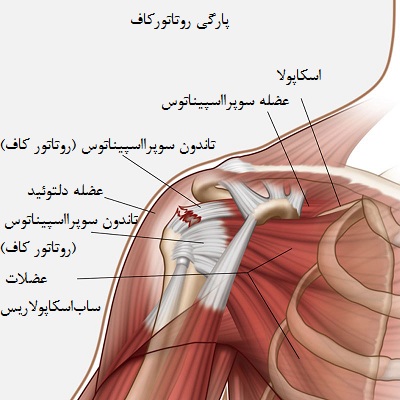 عملکرد عضله سوپراسپیناتوس از نظر آناتومی