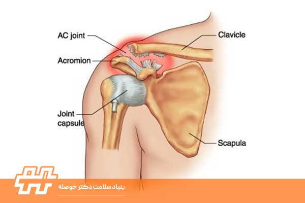 مفصل آکرومیوکلاویکولار