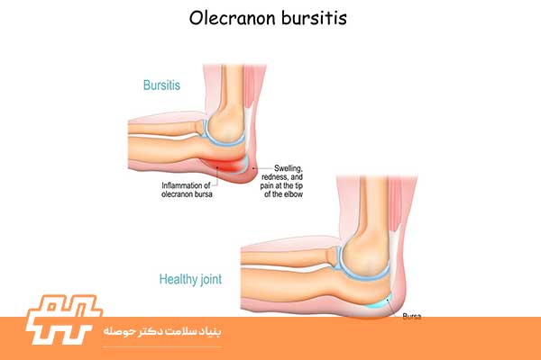 بورس آرنج