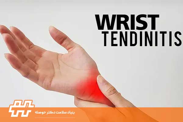 تاندونهای مچ دست