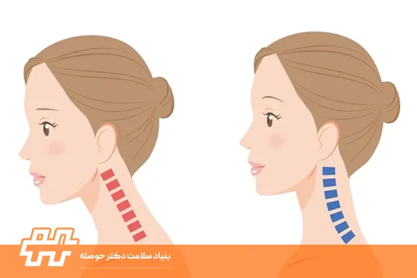 گردن صاف