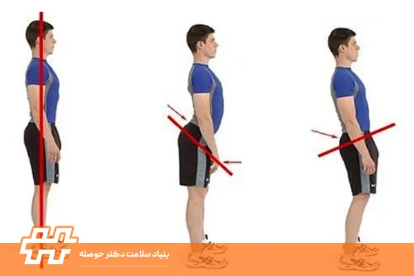 فرق بین تیلت خلفی و قدامی لگن