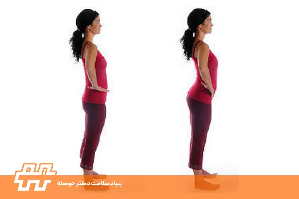 تمرین خانگی برای اصلاح تیلت قدامی لگن