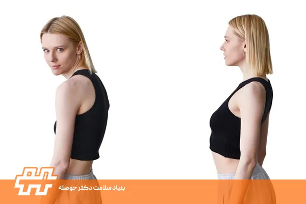 علائم تیلت خلفی لگن