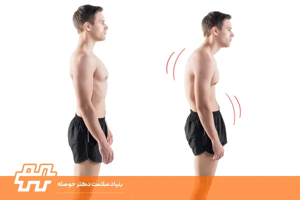 علائم تیلت قدامی لگن