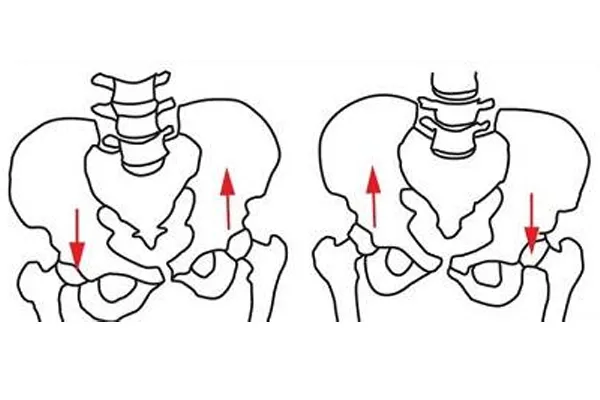چرخش داخلی و خارجی لگن