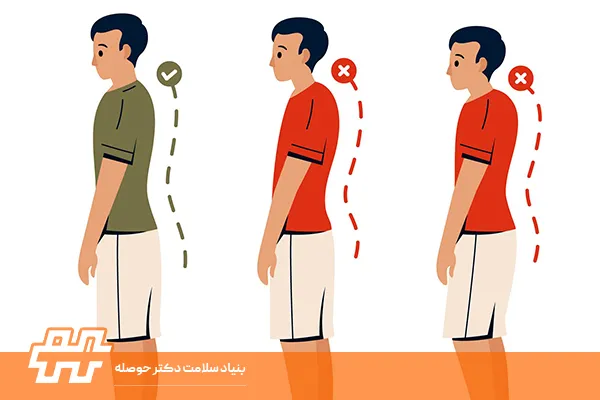 Flat Back یا Lordosis؟ تفاوت‌ها و راهکارها
