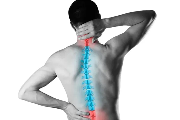 لاور کراست سندروم