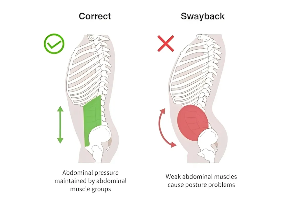 لوردوز کمری چیست؟
