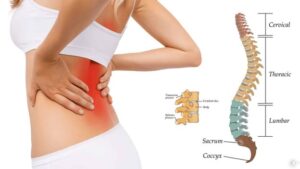 تشخیص تخصصی دیسک کمر چگونه انجام میشود؟