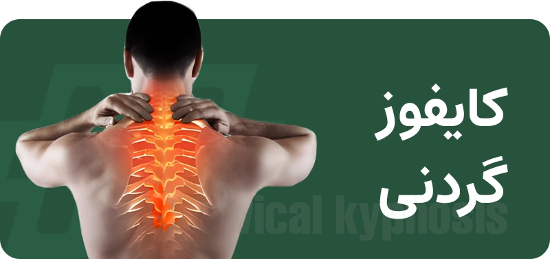 ناهنجاری سر و گردن