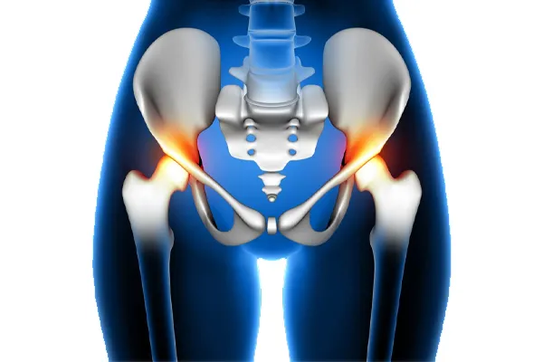 افتادگی لگن