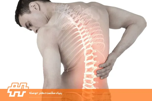 تشخیص اسکولیوز