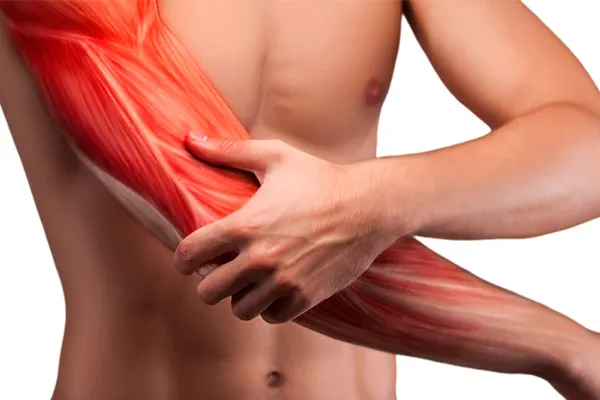 حرکات اصلاحی