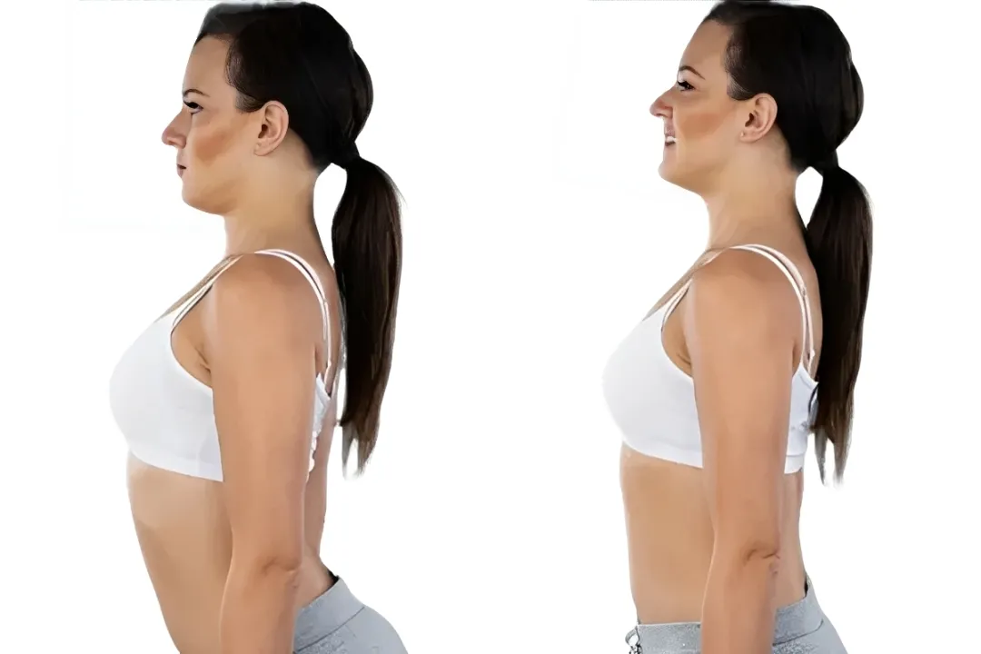 مقایسه لوردوز