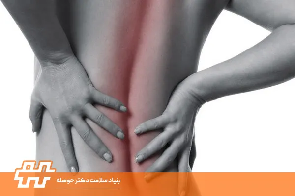 مقایسه لوردوز