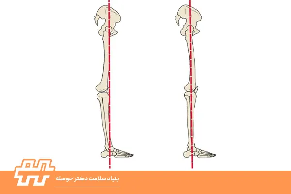 حرکت‌دادن زانو