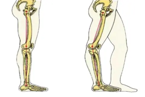 حرکتدادن زانو