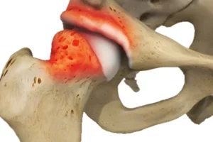 چرخش داخلی فمور