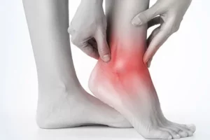 علل انحراف مچ پا