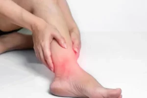 انحراف مچ پا