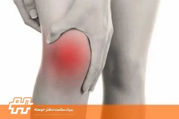 تمرینات مؤثر برای کنترل جلوآمدگی زانو و تقویت ثبات زانو