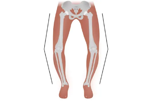علائم زانو پرانتزی