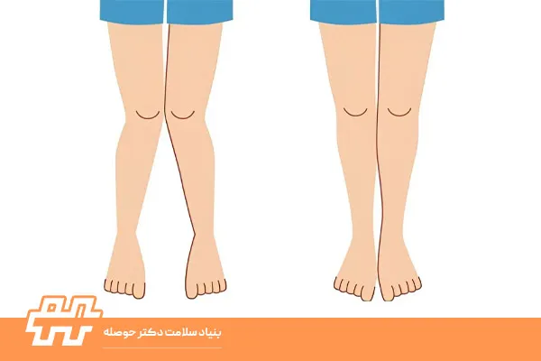 زانو ضربدری