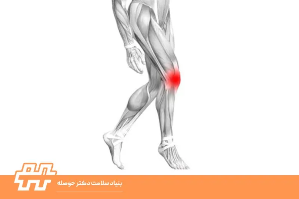 ضعف چرخش خارجی زانو