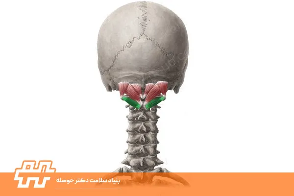 معرفی عضله ساب اکسیپیتال (Suboccipital)