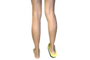 پای کوتاه‌تر