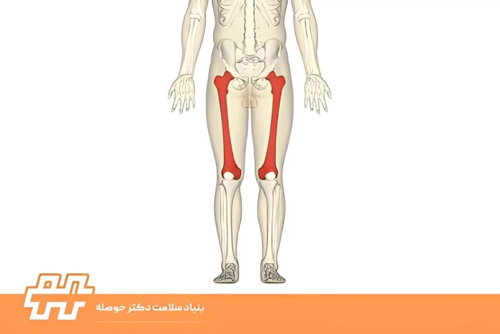 علائم چرخش داخلی فمور