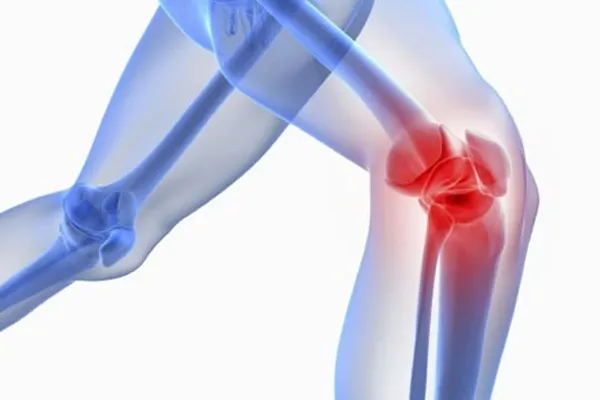 چرخش ناقص زانو