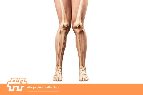 چه عواملی باعث زانو ضربدری می‌شن