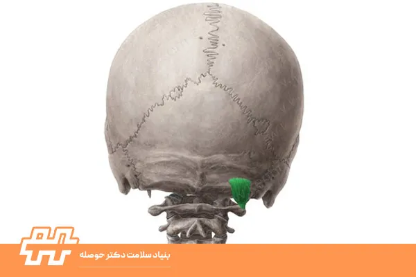 معرفی عضله ابلیکوس کپیتوس سوپریور (Obliquus Capitis Superior)