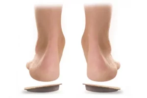 انحراف پاشنه