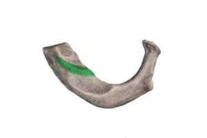 اسکالن میانی