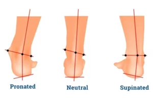 انحراف پاشنه