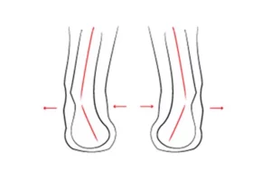 انحراف پاشنه