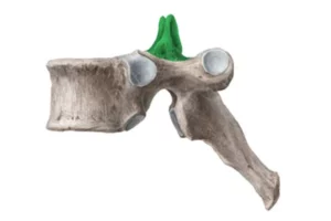 عضله مولتیفیدوس گردنی