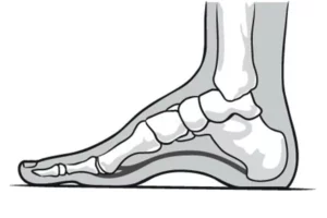 چگونه متوجه شویم پاهایمان قوس زیادی دارند