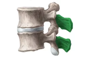 عضله مولتیفیدوس گردنی