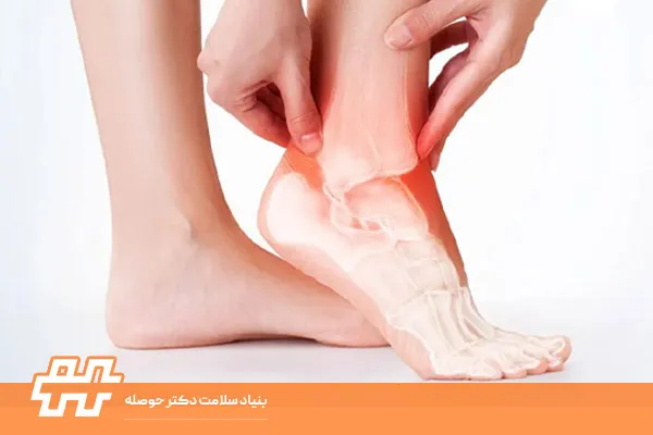 عوارض انحراف مچ پا بر زانو