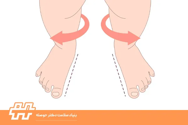 چرخش خارجی پا